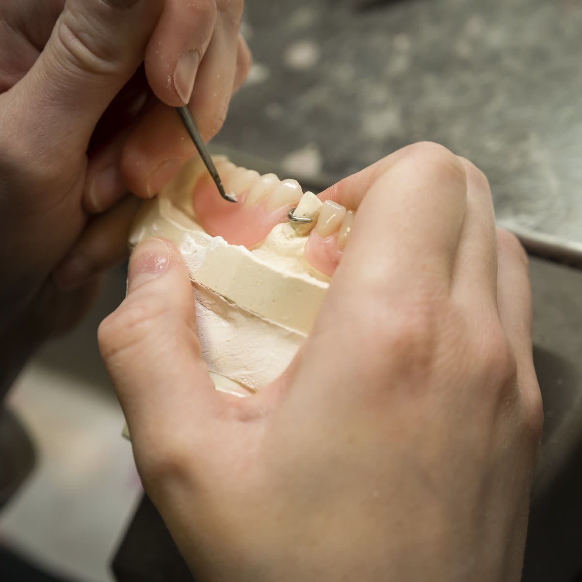 Contrôle et finition d’une prothèse au laboratoire Orviz