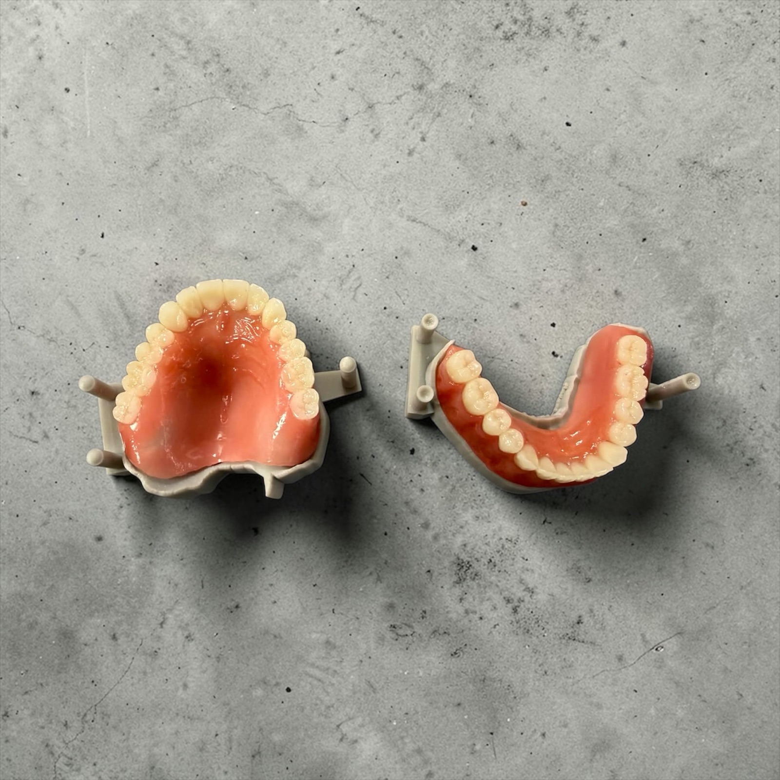 Deux prothèses adjointes en résine sur leurs modèles