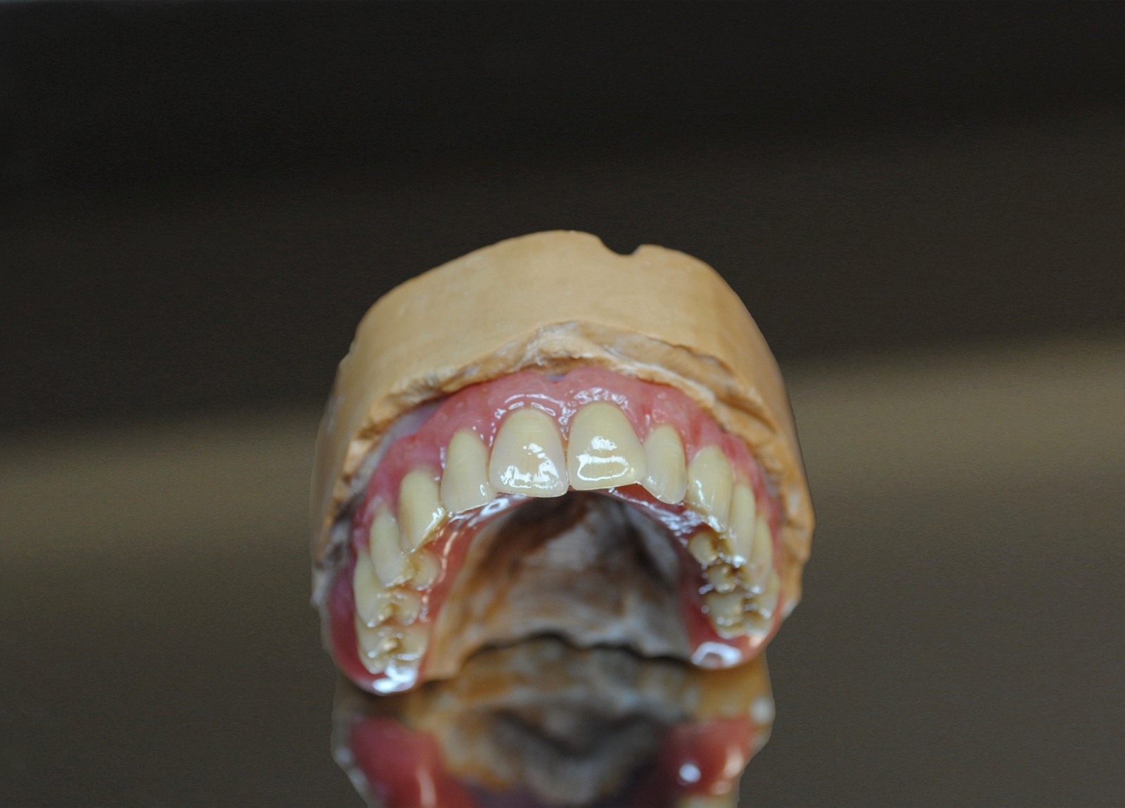 Restauration prothétique complète sur un modèle de laboratoire