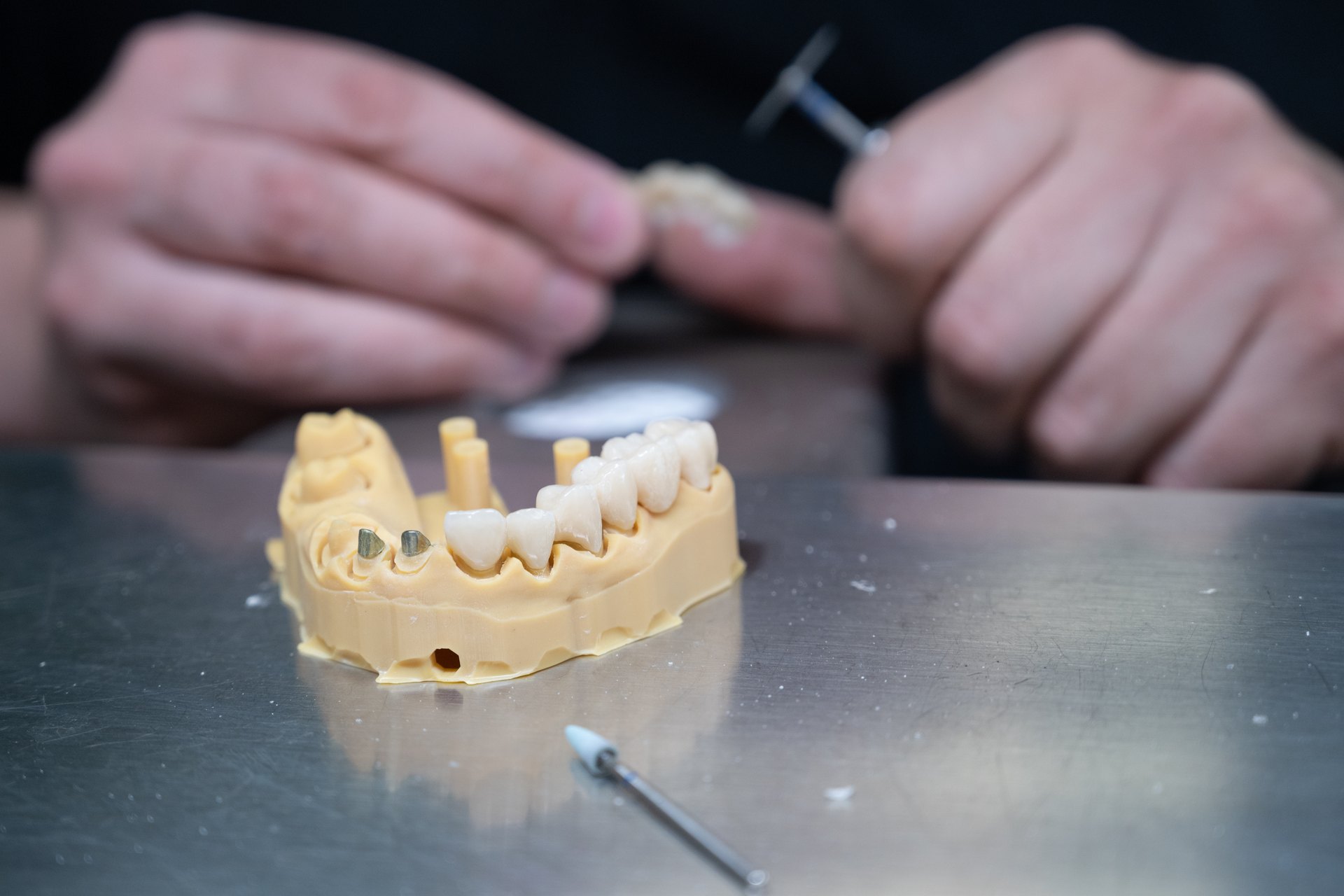 Un prothésiste travaille une restauration dentaire sur un modèle au laboratoire Orviz